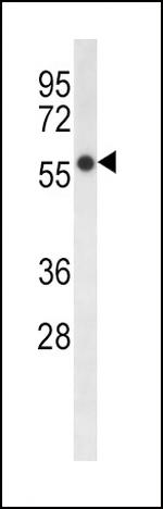 FADS2 Antibody in Western Blot (WB)