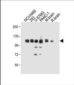 XYLT1 Antibody in Western Blot (WB)