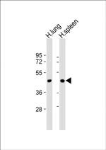 LOXL3 Antibody in Western Blot (WB)