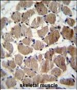 COCH Antibody in Immunohistochemistry (Paraffin) (IHC (P))