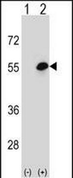 COCH Antibody in Western Blot (WB)