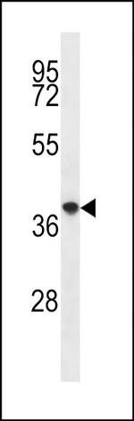 PQLC2 Antibody in Western Blot (WB)