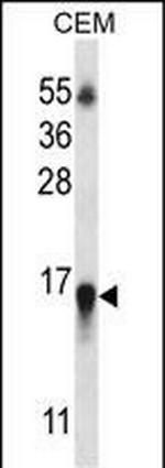 HIST1H2BN Antibody in Western Blot (WB)