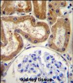 FGD2 Antibody in Immunohistochemistry (Paraffin) (IHC (P))