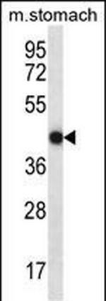 FGD2 Antibody in Western Blot (WB)