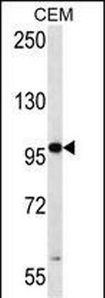 RNF43 Antibody in Western Blot (WB)