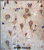 GPHB5 Antibody in Immunohistochemistry (Paraffin) (IHC (P))