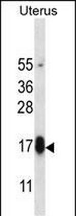 GPHB5 Antibody in Western Blot (WB)