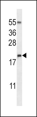 RNASE3 Antibody in Western Blot (WB)