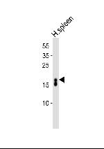 RNASE3 Antibody in Western Blot (WB)