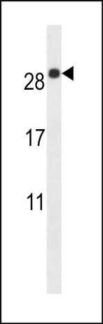 EMP2 Antibody in Western Blot (WB)