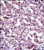 GDI2 Antibody in Immunohistochemistry (Paraffin) (IHC (P))