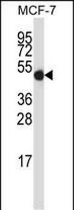 GDI2 Antibody in Western Blot (WB)