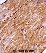 MAP4K3 Antibody in Immunohistochemistry (Paraffin) (IHC (P))