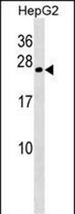 CRYGB Antibody in Western Blot (WB)