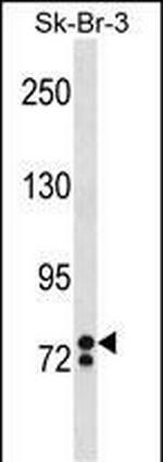 ZNF263 Antibody in Western Blot (WB)