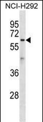 ATL1 Antibody in Western Blot (WB)