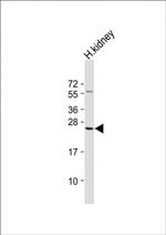 RAB28 Antibody in Western Blot (WB)