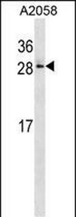 RAB28 Antibody in Western Blot (WB)