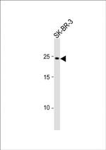 RAB32 Antibody in Western Blot (WB)