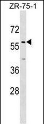 ZNF10 Antibody in Western Blot (WB)