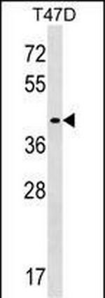 MMADHC Antibody in Western Blot (WB)