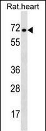 STRA6 Antibody in Western Blot (WB)