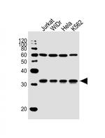 EXOSC6 Antibody in Western Blot (WB)