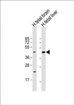 SLC30A10 Antibody in Western Blot (WB)