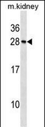 Recoverin Antibody in Western Blot (WB)