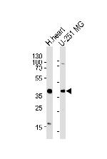 AKTIP Antibody in Western Blot (WB)