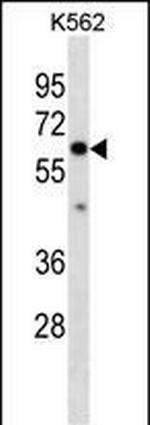 Collagen X Antibody in Western Blot (WB)