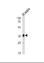 PBK Antibody in Western Blot (WB)