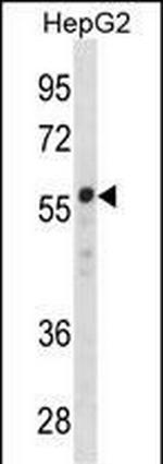 ZNF276 Antibody in Western Blot (WB)