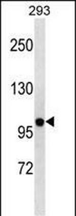 KV2.2 (KCNB2) Antibody in Western Blot (WB)