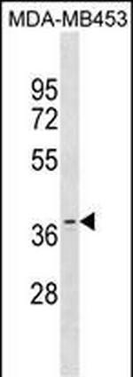 OR11A1 Antibody in Western Blot (WB)