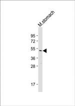 TXNIP Antibody in Western Blot (WB)