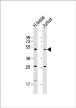 OXCT2 Antibody in Western Blot (WB)