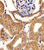 Adenylate Kinase 4 Antibody in Immunohistochemistry (Paraffin) (IHC (P))