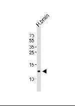 HBG2 Antibody in Western Blot (WB)