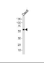 CHRNA9 Antibody in Western Blot (WB)