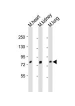 BRD7 Antibody in Western Blot (WB)