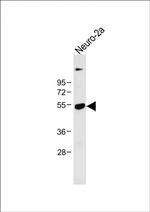 CLN3 Antibody in Western Blot (WB)