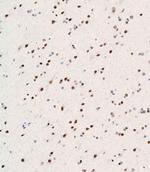 WDR82 Antibody in Immunohistochemistry (Paraffin) (IHC (P))