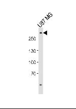 ABCA2 Antibody in Western Blot (WB)