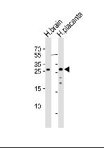 CHMP4A Antibody in Western Blot (WB)