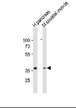 B4GALT7 Antibody in Western Blot (WB)