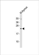 GINS1 Antibody in Western Blot (WB)