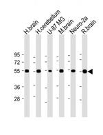 NRXN1 Antibody in Western Blot (WB)