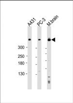 DYNC1H1 Antibody in Western Blot (WB)